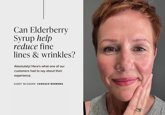 Elderberry for Your Skin?